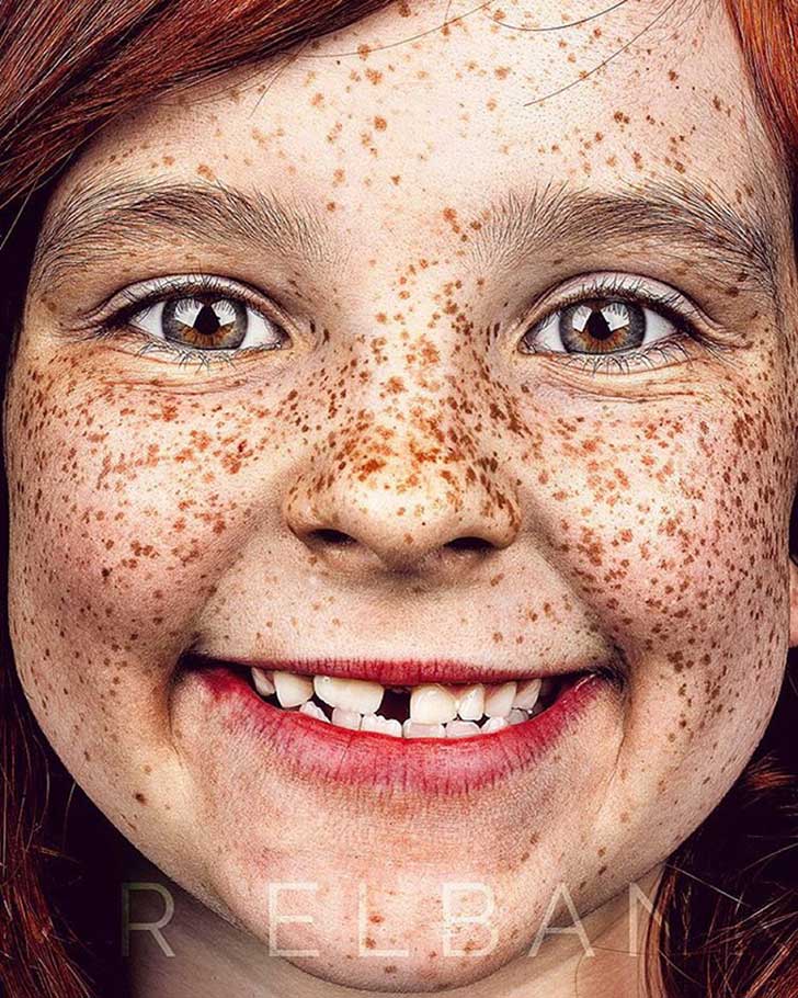 spanzion_freckles-portrait-photography-brock-elbank-135__700